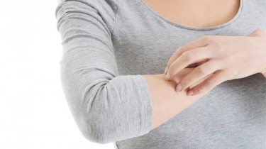 Eczema atopico: tutti i rimedi naturali