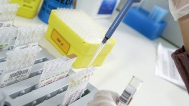 Nuovo test: diagnosi meningite in un'ora